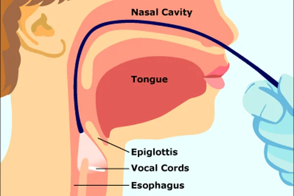 Laryngopharyngoscopy