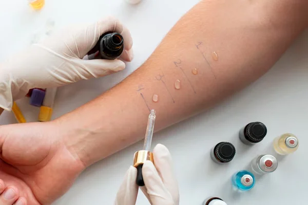 Allergy Testing and Immunisation