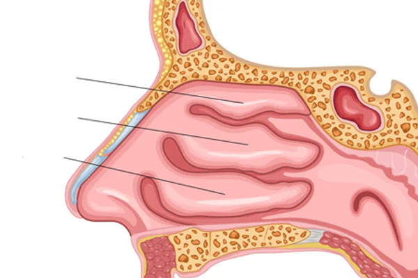 Turbinoplasty