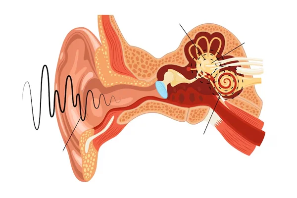 Stapedotomy